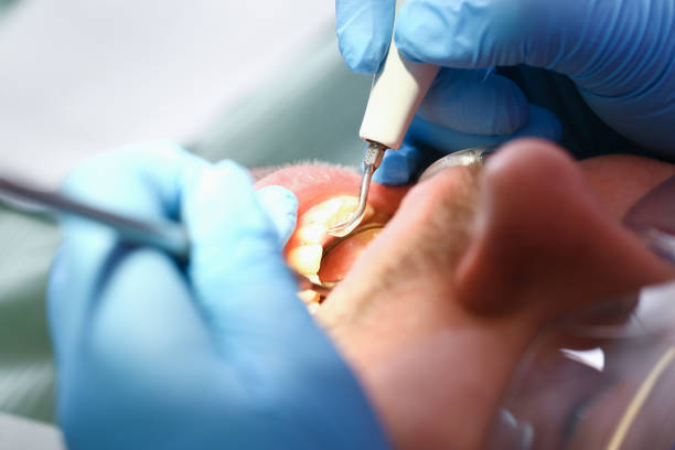 Best Emergency Dental Care for Sports Injuries in Augusta, KS