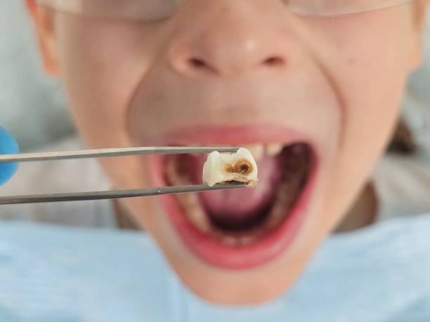 Best Emergency Denture Repair in Augusta, KS