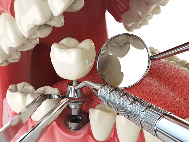 Best Walk-In Emergency Dental Services in Augusta, KS